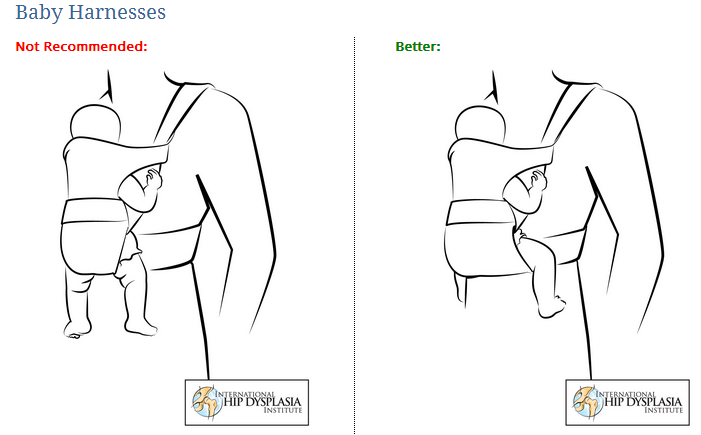 International Hip Dysplasia Insittute's vergelijking